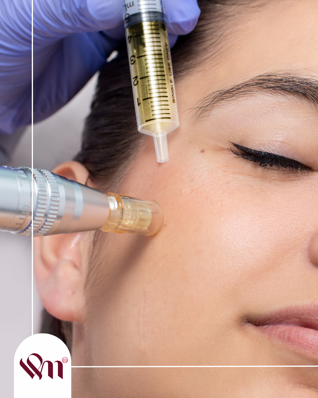 armonia orofacial